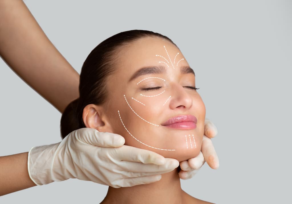 Woman with facial mapping lines drawn on face by practitioner in gloves, demonstrating Sculptra injection planning for collagen stimulation treatment areas