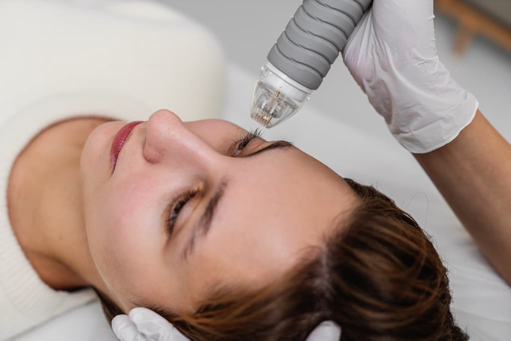 Achieve Revived, Supple Skin with Fractional RF Microneedling