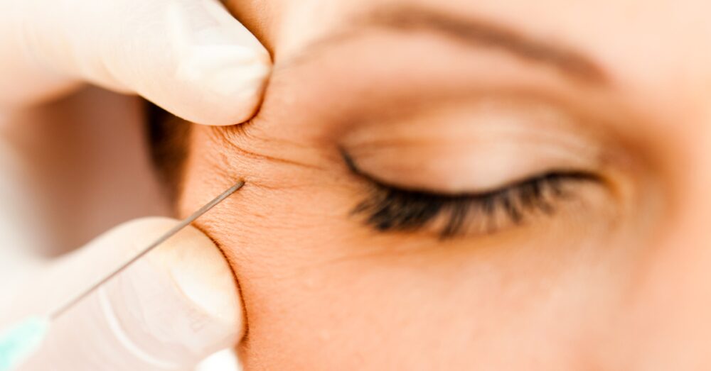 woman receiving Botox for crow’s feet